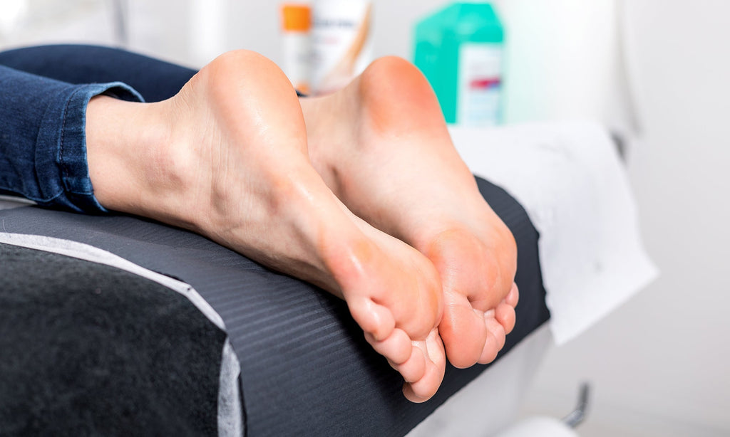 4 Things to Do to Remove Callus on Your Feet