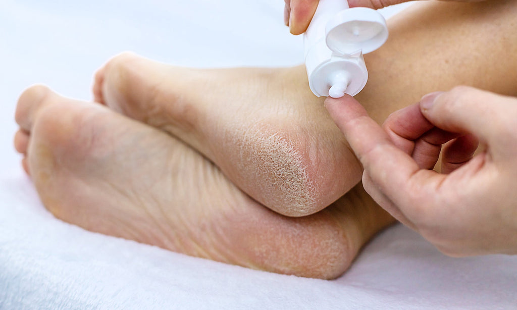 5 Steps to Properly Exfoliate Your Feet